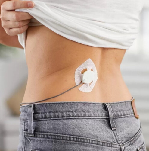 Уред за ултразвукова терапия Medisana PT 100 PainShield